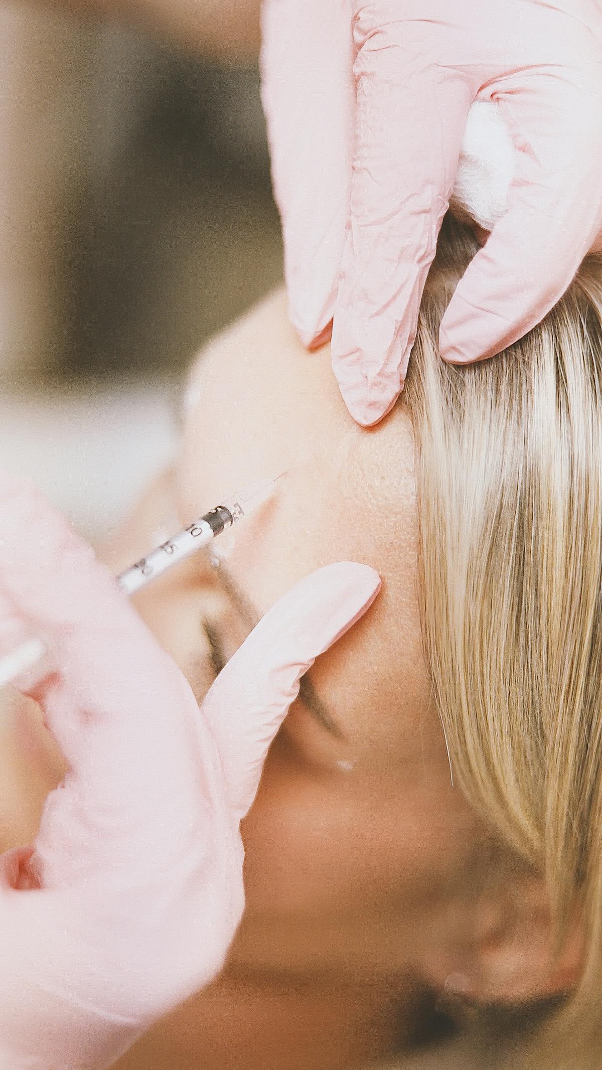 Bioestimulación facial con infiltración real en consulta